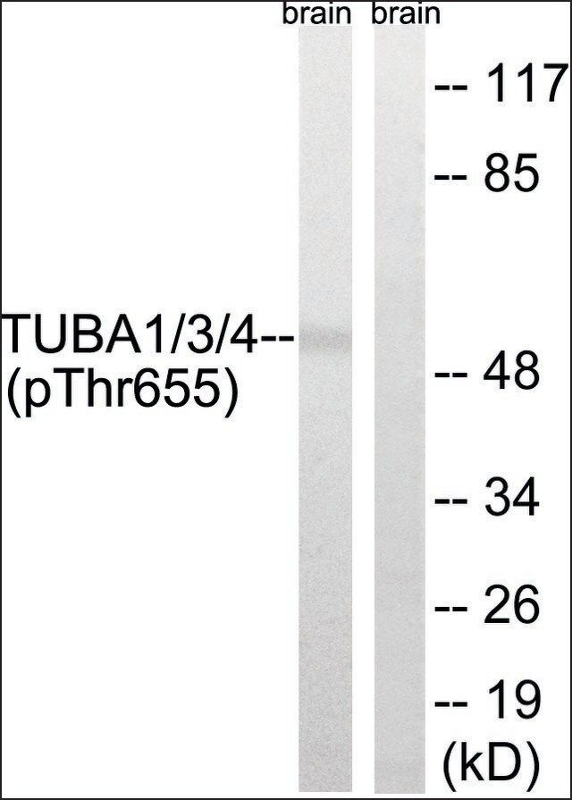 Anti-phospho-TUBA1/3/4 (pTyr<sup>272</sup>) antibody produced in rabbit