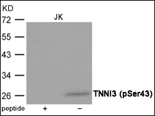 Anti-phospho-TNNI3 (pSer<sup>43</sup>) antibody produced in rabbit