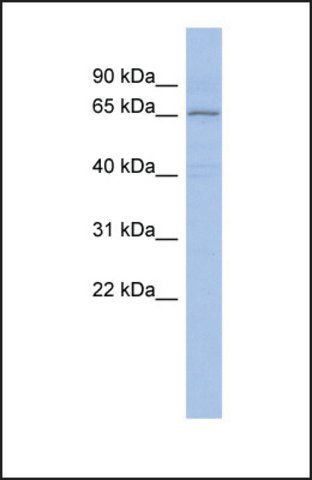 Anti-PIAS1 antibody produced in rabbit