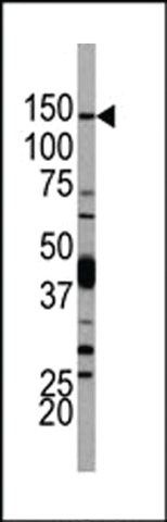 ANTI-PI3KCD(N-TERMINAL) antibody produced in rabbit