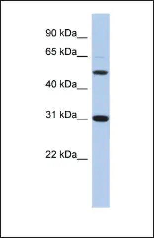 Anti-PI16 antibody produced in rabbit