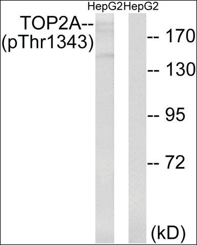 Anti-phospho-TOP2A (pThr<sup>1343</sup>) antibody produced in rabbit