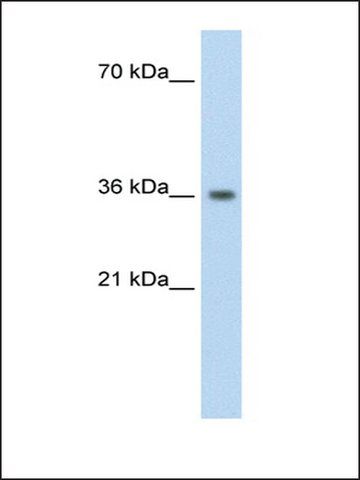 Anti-PHYHIP (AB2) antibody produced in rabbit