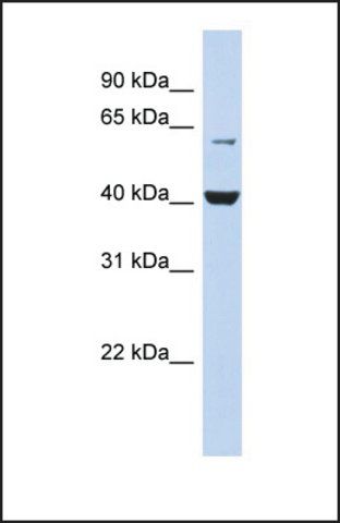 Anti-PIGK, (N-terminal) antibody produced in rabbit