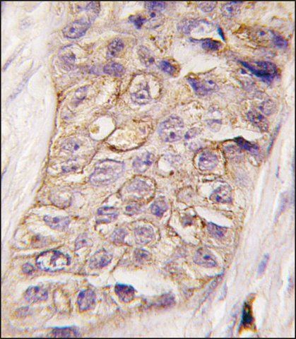 ANTI-PI3KC2B(N-TERMINAL) antibody produced in rabbit