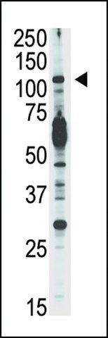 ANTI-PI3KCD(C-TERMINAL) antibody produced in rabbit