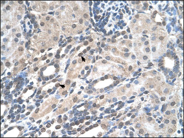 Anti-PIGV antibody produced in rabbit