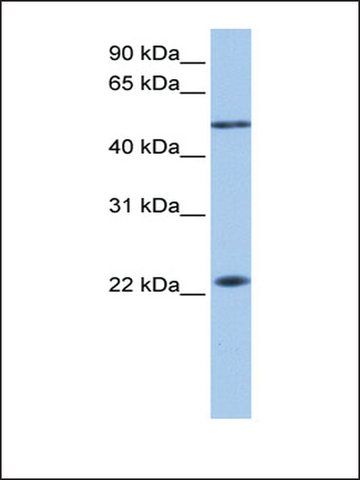 Anti-PIAS2 (AB2) antibody produced in rabbit