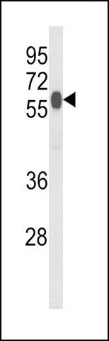 ANTI-PHYH2(C-TERMINAL) antibody produced in rabbit