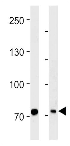 ANTI-PID/MTA2(C-TERMINAL) antibody produced in rabbit