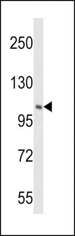 ANTI-PIK4CB (CENTER) antibody produced in rabbit