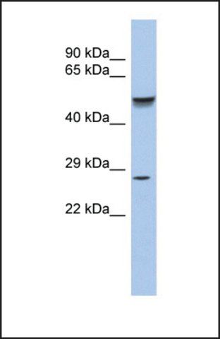 Anti-PHOX2A, (N-terminal) antibody produced in rabbit