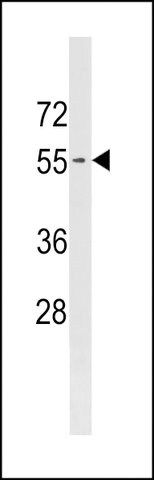 ANTI-PIGB(N-TERMINAL) antibody produced in rabbit