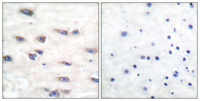 Anti-phospho-Trk A (pTyr<sup>791</sup>) antibody produced in rabbit