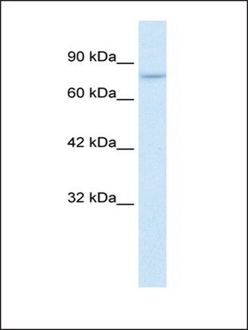 Anti-PIAS2 (AB2) antibody produced in rabbit