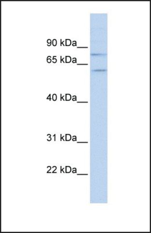 Anti-PIAS1, (N-terminal) antibody produced in rabbit