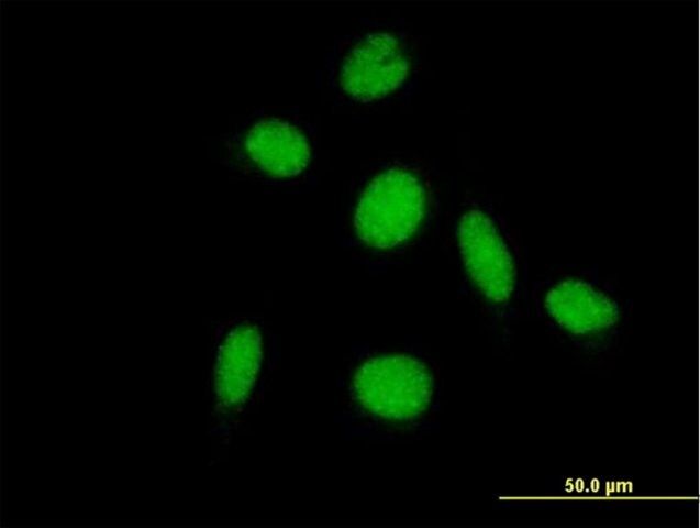 Anti-PIAS2 antibody produced in mouse