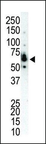 ANTI-PKC ETA(N-TERMINAL) antibody produced in rabbit