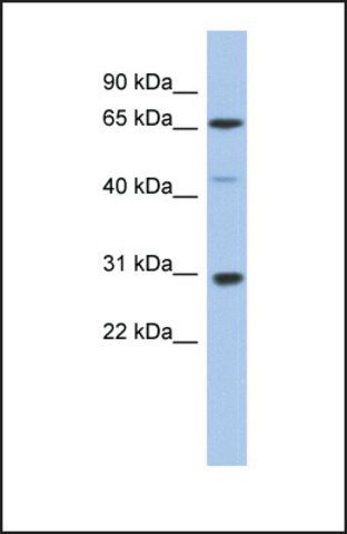 Anti-PIAS3 antibody produced in rabbit