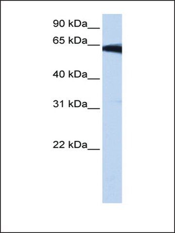 Anti-PIGW antibody produced in rabbit