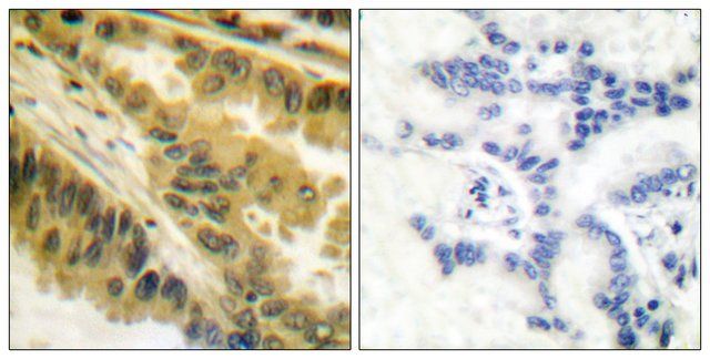 Anti-PKC  antibody produced in rabbit