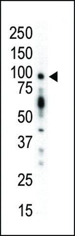 ANTI-PKC MU(N-TERMINAL) antibody produced in rabbit