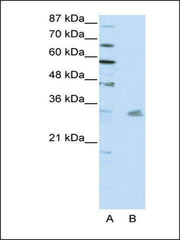 Anti-PITX3 antibody produced in rabbit