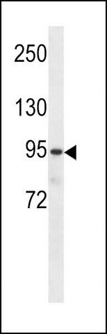 ANTI-PKP3 (C-TERM) antibody produced in rabbit