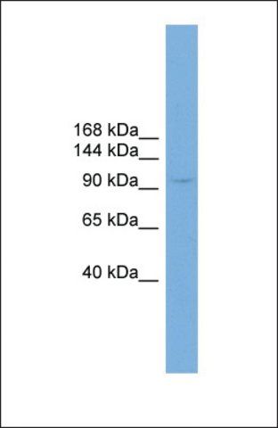 Anti-PIWIL4, (N-terminal) antibody produced in rabbit