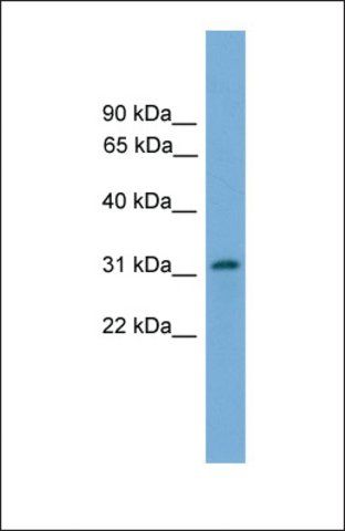 Anti-PIGL, (N-terminal) antibody produced in rabbit