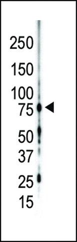 ANTI-PKC GAMMA(C-TERMINAL) antibody produced in rabbit