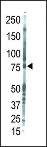 ANTI-PKC THETA(C-TERMINAL) antibody produced in rabbit