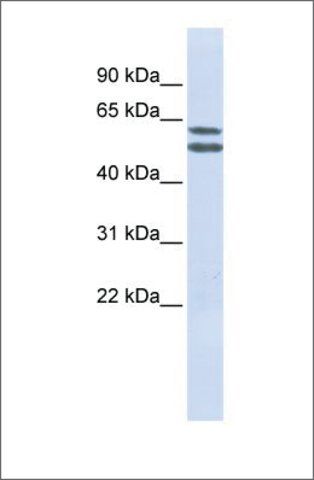 Anti-PIGQ antibody produced in rabbit