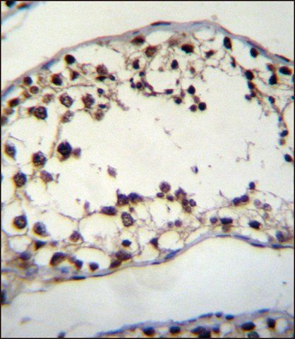 ANTI-PIH1D2 (C-TERM) antibody produced in rabbit