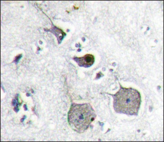 Anti-PIK3R2 (N-term) antibody produced in rabbit