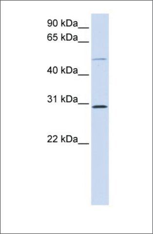 Anti-PLA1A antibody produced in rabbit