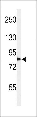 ANTI-PLA2G4B (CENTER) antibody produced in rabbit