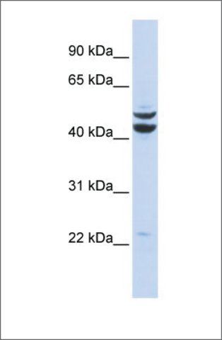 Anti-PKNOX2 antibody produced in rabbit