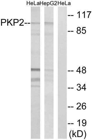 Anti-PKP2 antibody produced in rabbit