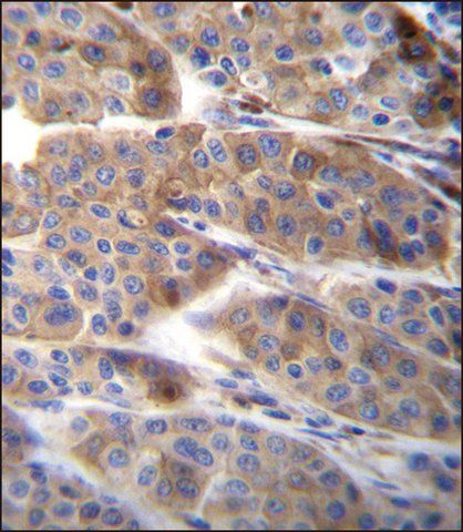 ANTI-PLA2G2C (C-TERM) antibody produced in rabbit