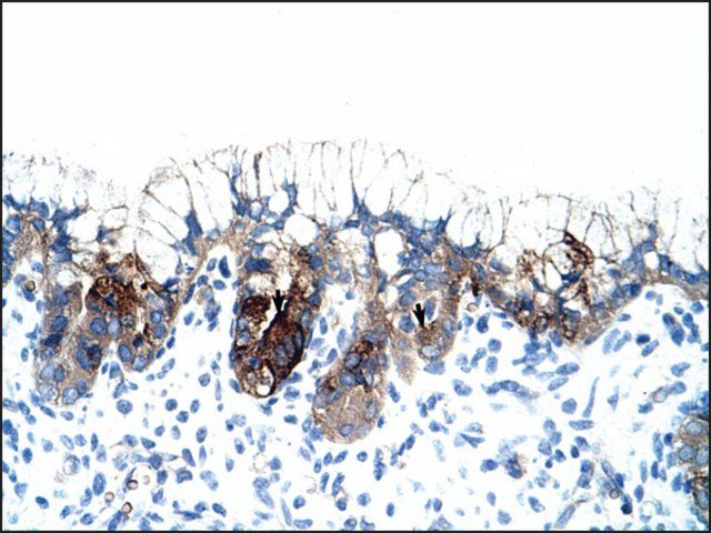 Anti-PMF1 (AB1) antibody produced in rabbit