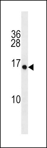 ANTI-PLGLA(N-TERMINAL) antibody produced in rabbit