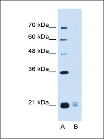 Anti-PLAC1L antibody produced in rabbit