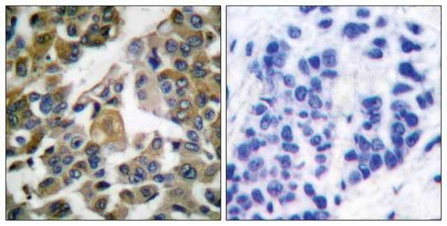 Anti-PLCG1 antibody produced in rabbit