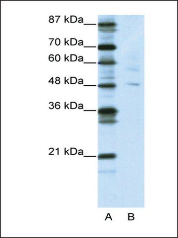 Anti-PLAGL1 antibody produced in rabbit