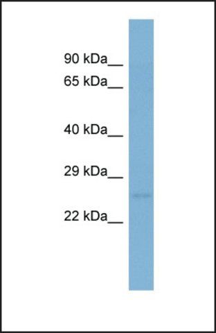 Anti-PLDN, (N-terminal) antibody produced in rabbit