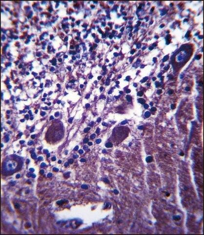 ANTI-PLXNC1 (C-TERM) antibody produced in rabbit