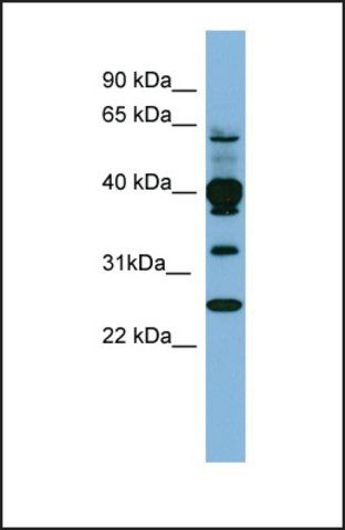 Anti-PLEK, (N-terminal) antibody produced in rabbit