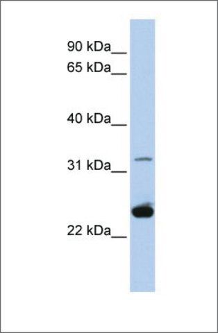 Anti-PLP1 (ab2) antibody produced in rabbit