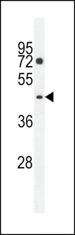 ANTI-PM20D2(C-TERMINAL) antibody produced in rabbit